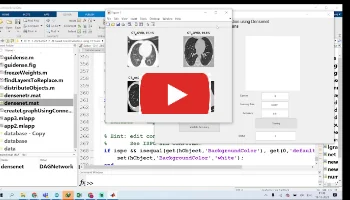 AI Based Covid Detection using CT Scans - Matlab Deep Learning Projects