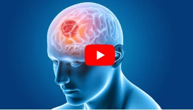 Brain Tumor Classification Using RST Features in MATLAB | AI-Driven Medical Imaging