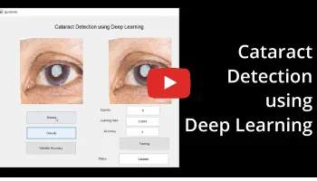 Cataract Detection using Deep Learning