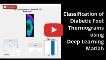 Classification of Diabietic Foot Thermograms using Deep Learning Matlab