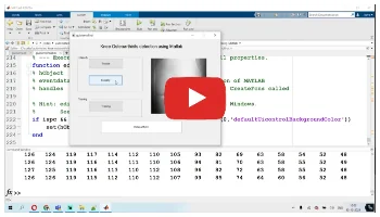 Knee Osteoarthritis Detection using Matlab