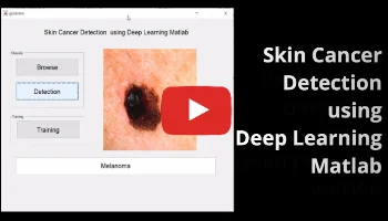 Skin Cancer Detection using Deep Learning Matlab